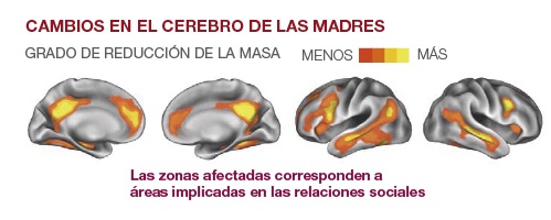 cerebro-madre